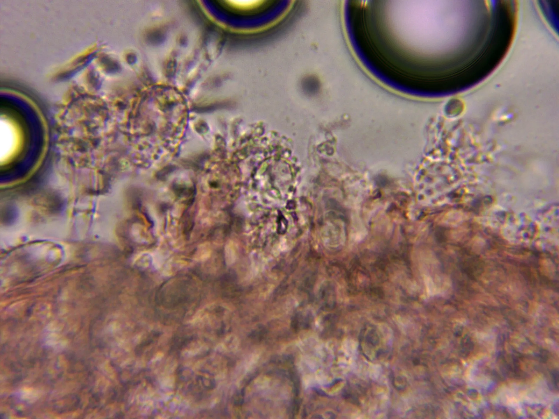 Microscopía de Mycena clavicularis - 10 - Queilocistidios abundantes